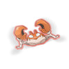 Krabby