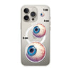 Veined Eyeball