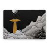 SkyPulse - MacBook